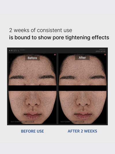 Zero Pore Pad 2.0