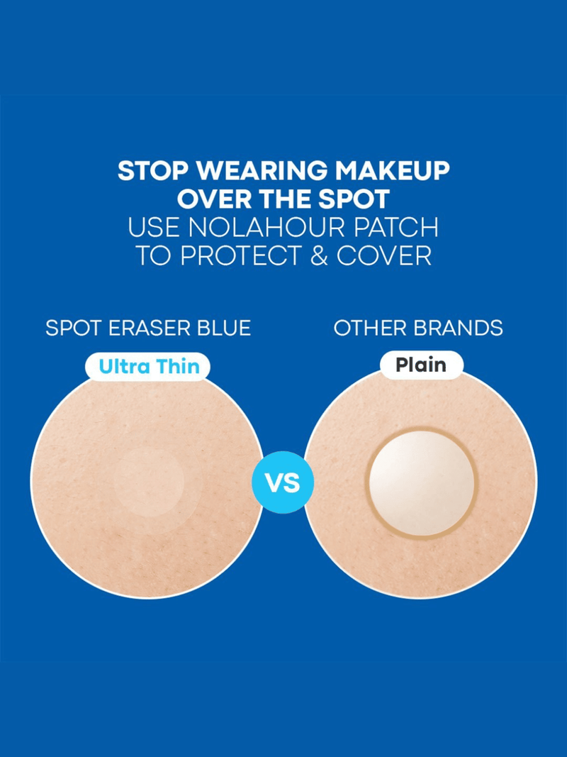 Spot Eraser Blue - Step 2 (63pcs)